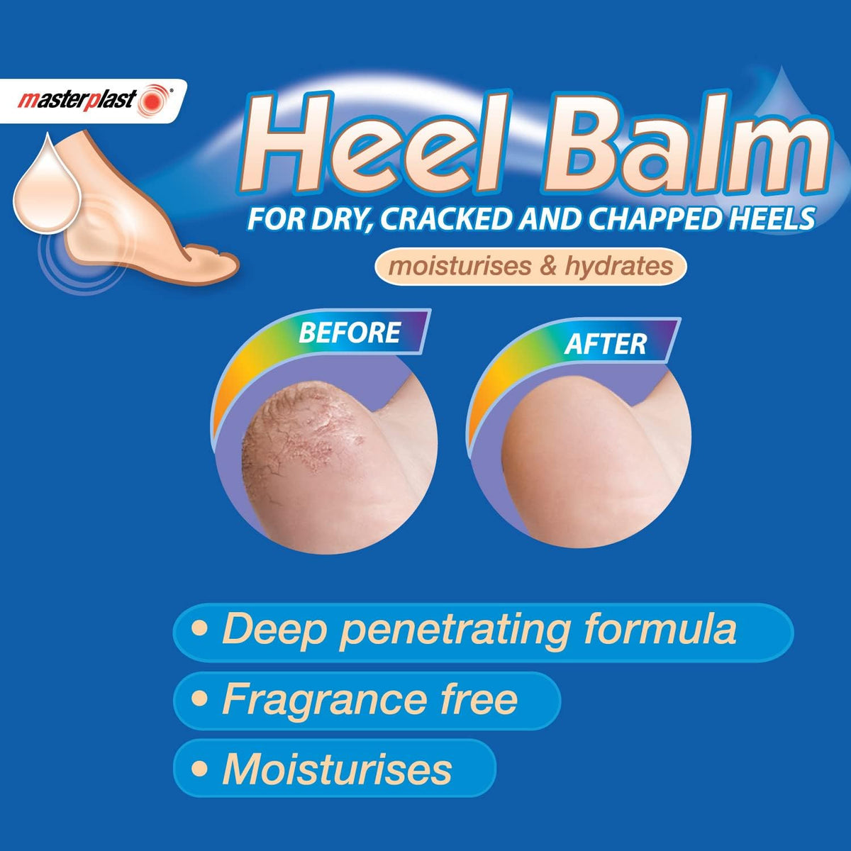 MasterPlast | Heel Balm | 70g